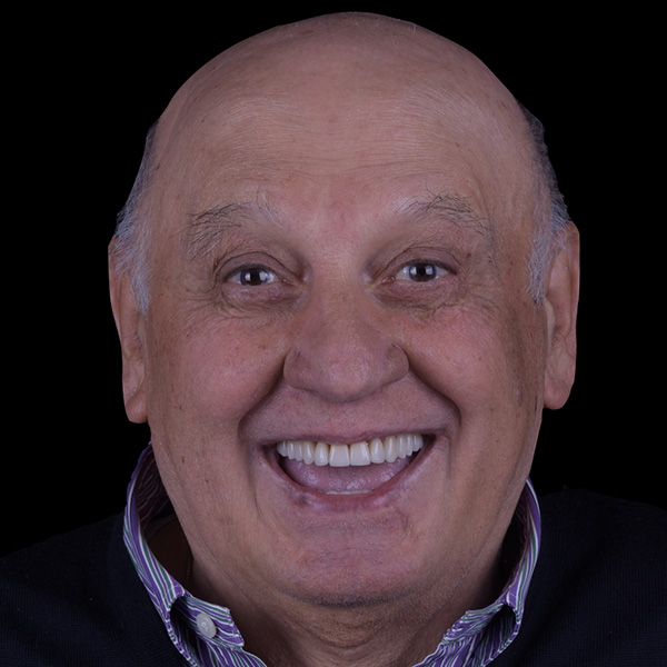 Faccette dentali risultato 1 pieroni - Studio dentistico Pieroni