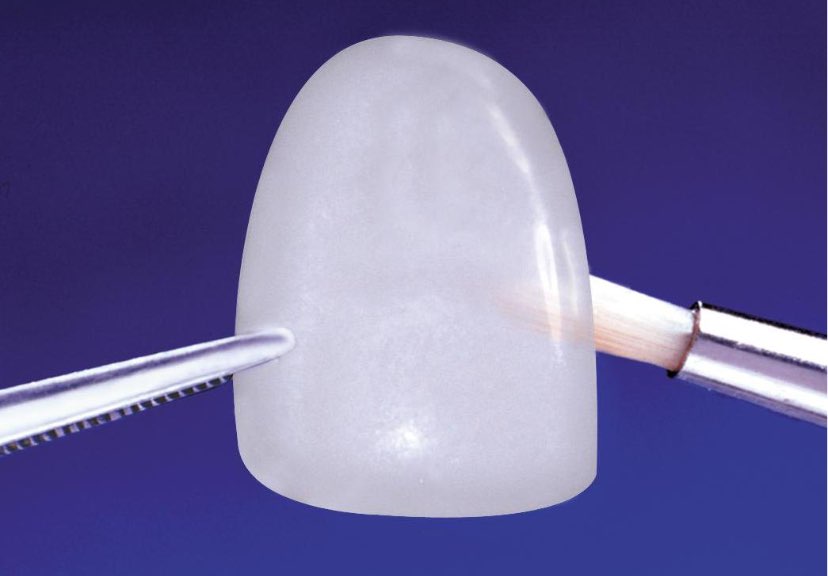 Studio dentistico Pieroni | faccette estetiche dentali Milano Porta Venezia