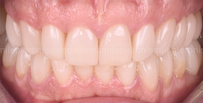 Pieroni Caso10 dopo - Studio dentistico Pieroni