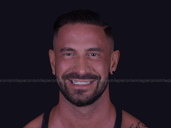 Pieroni Caso2 - Studio dentistico Pieroni