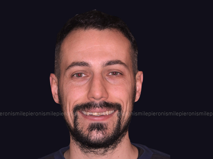 Pieroni Caso5 - Studio dentistico Pieroni