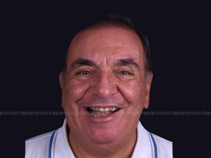 Pieroni Caso6 - Studio dentistico Pieroni