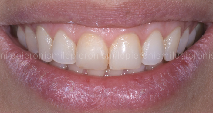 Pieroni Caso7 - Studio dentistico Pieroni