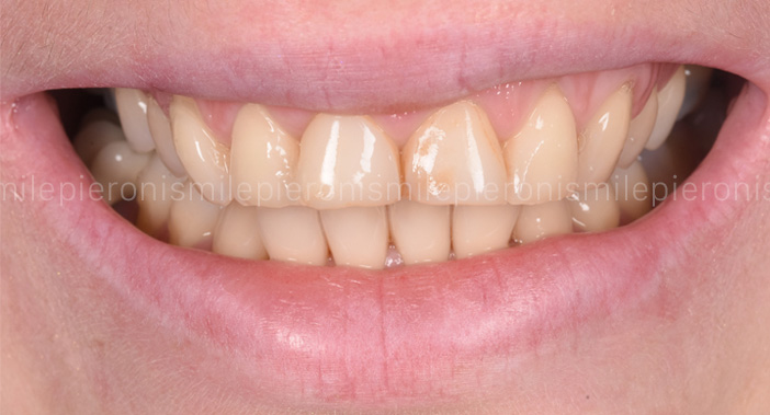 Pieroni Caso9 - Studio dentistico Pieroni