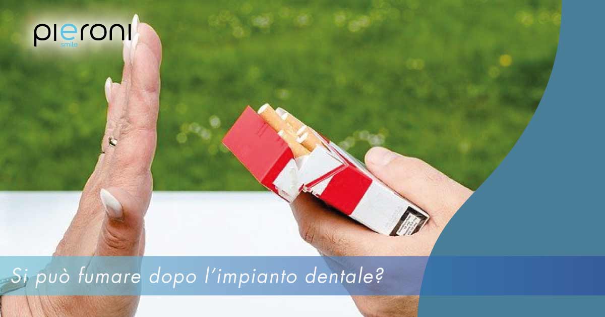 fumare dopo impianto dentale||