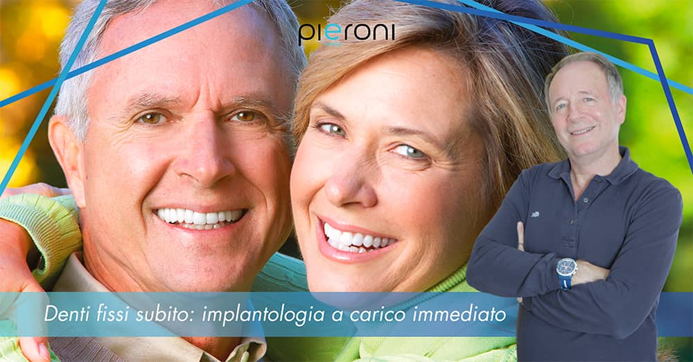 carico immediato|carico immediato|carico immediato