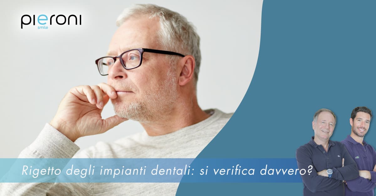 rigetto impianti dentali|||